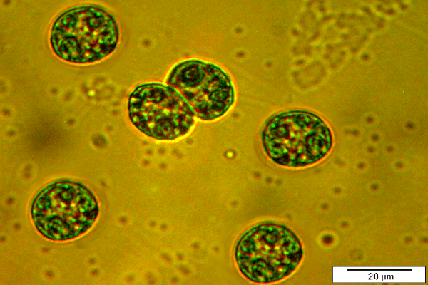 Selbst kultivierte Haematococcus Algen unter dem Mikroskop. Sie dienen als Futter für weitere Planktonzucht, als Fischfutter für herbivore Fischlarven und der Wasseraufbereitung bei Aquaponics im weiteren Sinne.